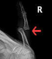 Thumbnail for version as of 12:50, 29 May 2026