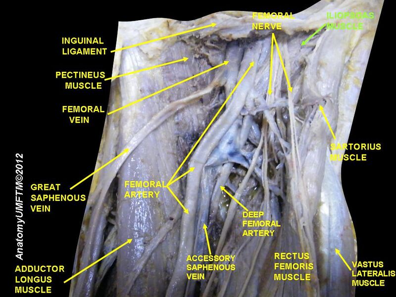 File:Slide20LLLL.JPG