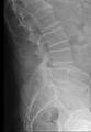 Thumbnail for version as of 22:25, 8 June 2026