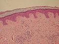 Epidermis