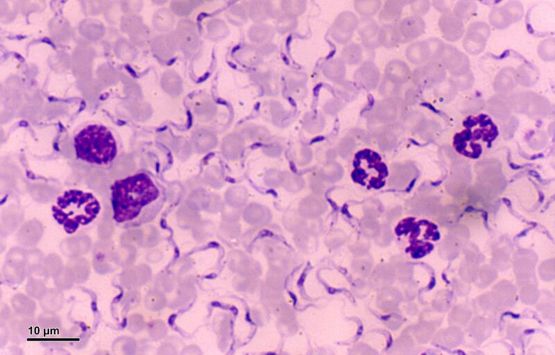 File:Trypanosoma (248 09) Trypanosoma equiperdum.jpg