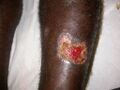 Leishmania major