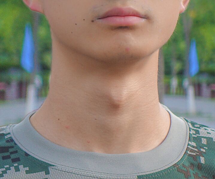 File:Adam's apple 26.jpg