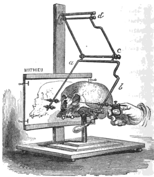 File:Stereograph Broca.png