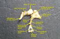 View of the tympanic cavity.