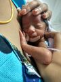 Mother practicing Kangaroo Mother Care