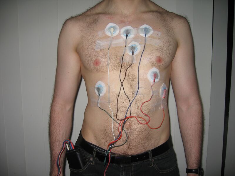 File:Holter monitor.JPG