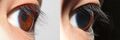 Pupil