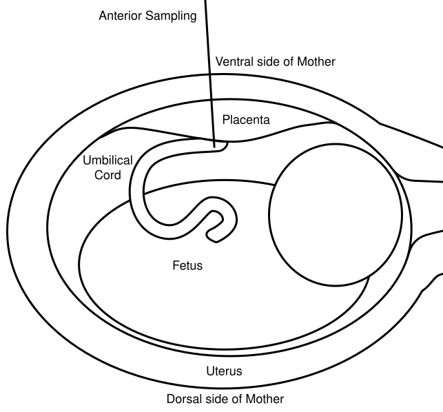 File:Anterior Sampling.svg