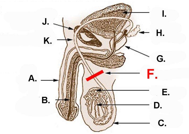File:Vasectomy.jpg