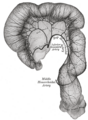 Anatomical illustration of the pelvic arteries