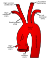 Diagram of the subclavian artery and its branches