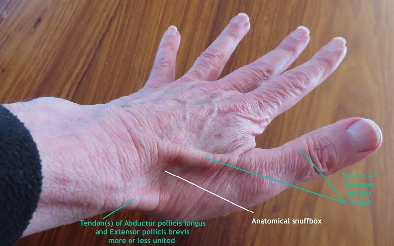 File:Anatomical snuffbox IMG 6853 a.jpg