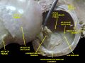 Image of the acetabular fossa in a dissected hip joint.