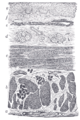 Gray's Anatomy illustration of the liver
