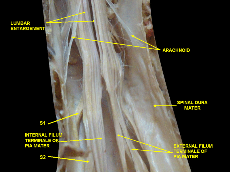 File:Slide5sese.GIF
