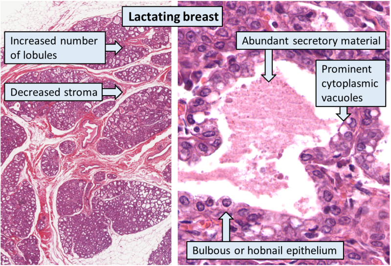 File:Histology of lactating breast, annotated.png