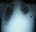 Thumbnail for version as of 03:35, 5 June 2026