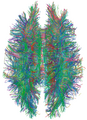 White Matter Connections Obtained with MRI Tractography