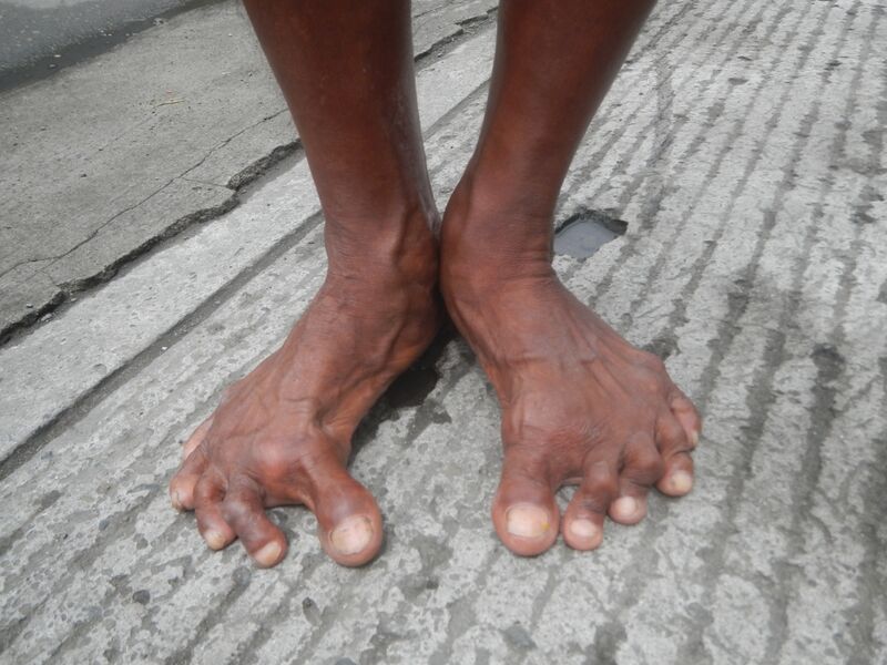File:4781Disabled people from Bulacan 12.jpg