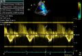 Thumbnail for version as of 13:40, 8 June 2026