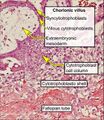 Cytotrophoblast