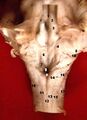 Dorsal cochlear nucleus