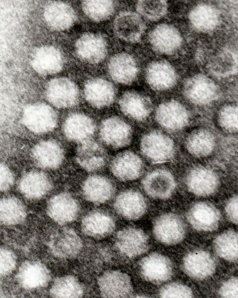 File:Adeno-associated viruses.jpg