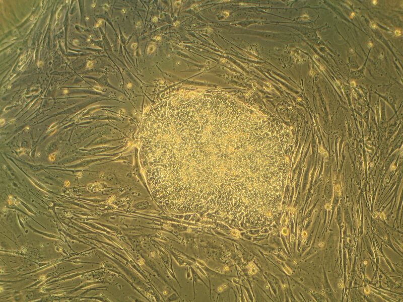 File:Humanstemcell.JPG