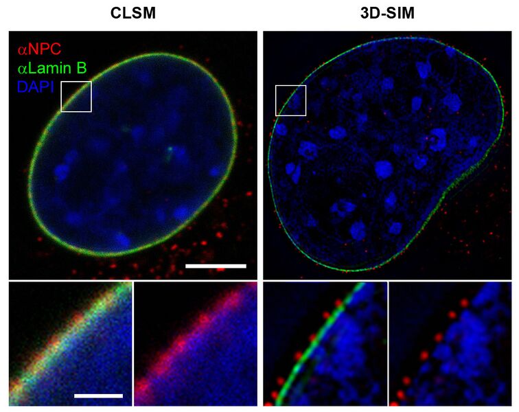 File:3D-SIM-1 NPC Confocal vs 3D-SIM.jpg