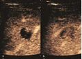 Thumbnail for version as of 13:40, 8 June 2026